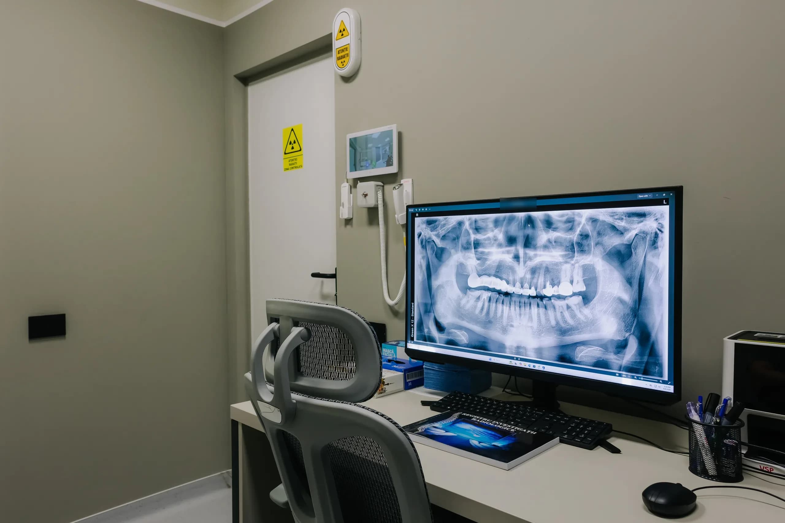 Radiografie panoramică afișată pe monitorul camerei de interpretare